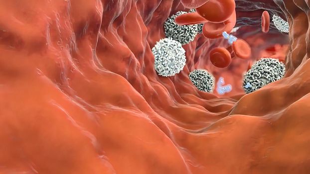 antibody cells destroy tumor cells