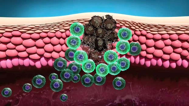 cells destroy cancer 3d medical
