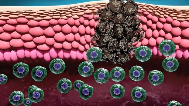 cells destroy cancer 3d medical