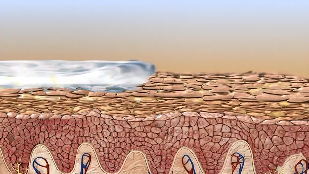 The epidermis is the outer layer of the skin defined as a stratified squamous epithelium.