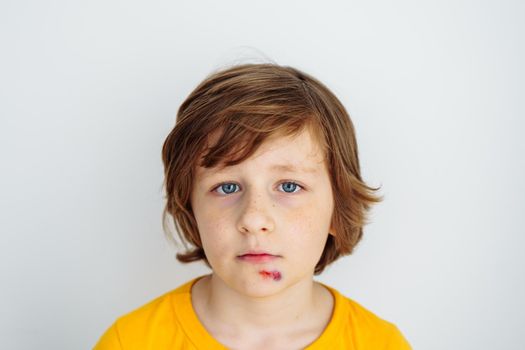 Portrait of school boy kid child with sore bruised wound on his face. Caucasian schoolboy in yellow t-shirt hurt his face on white background with copy space for text