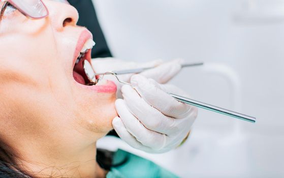 Dentist checking patient's mouth, Close up of patient checked by dentist, close up of dentist's hands checking patient's mouth, Dentist performing stomatology