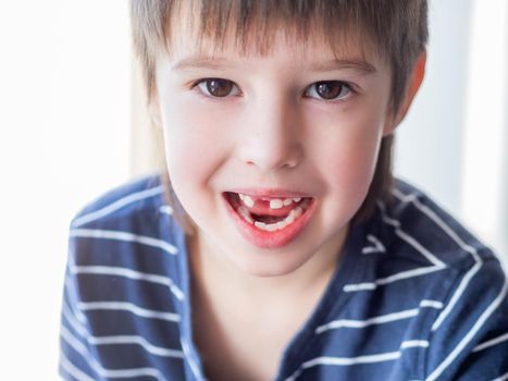 Smiling kid shows hole in row of teeth in his mouth. One incisor fell out just now. Close up photo of gums for dentist.