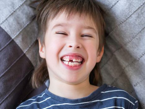 Laughing kid shows hole in row of teeth in his mouth. One incisor fell out just now. Close up photo of gums for dentist.