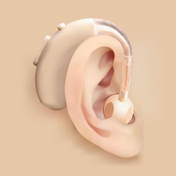 Hearing aid behind the ear. Ear and sound amplifier. Deafness and hearing loss. Treatment and prosthetics in otolaryngology. Medicine and health. Realistic object. Vector