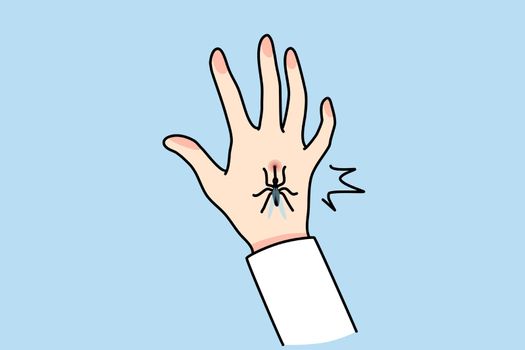 Mosquito bite person hand