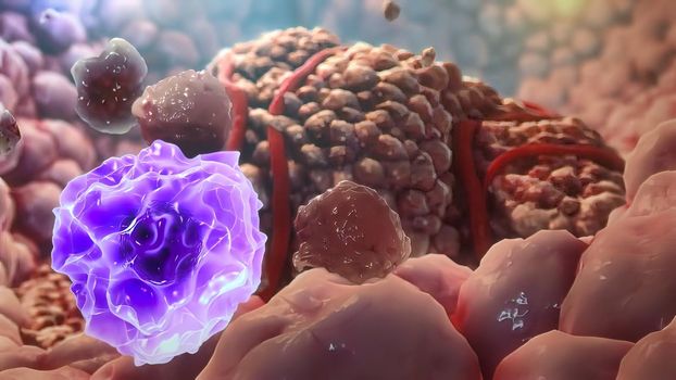 3D illustration Immune Cells Destroy Cancer Cells