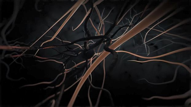 Death of neurons 3d medical