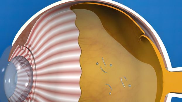 3D illustration medical animated eye anatomy, eye stain formation