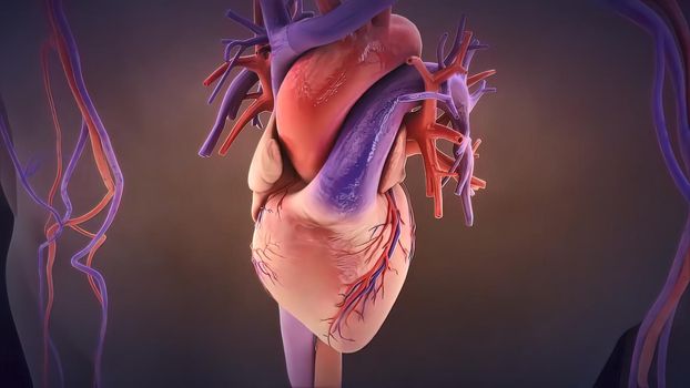 heart valve inflammation 3d medical