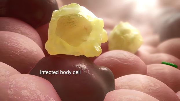 Immune cell destroys the infected body cell