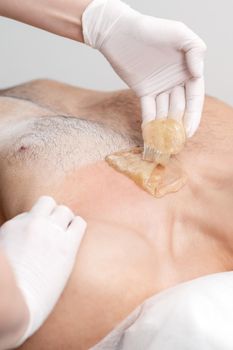 Epilation chest of young male