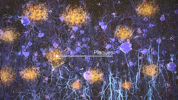 Neurons in action. electrical impulses between neuronal connections