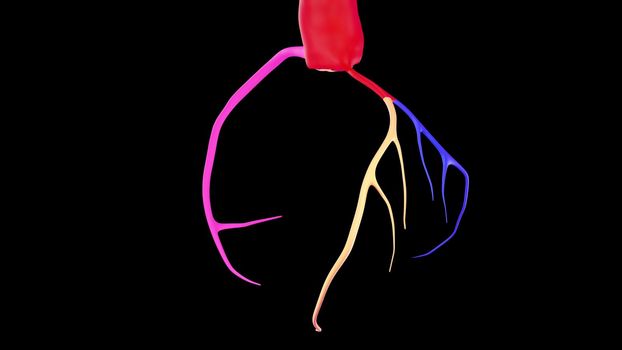 CTA Coronary artery  3D rendering 7.2020