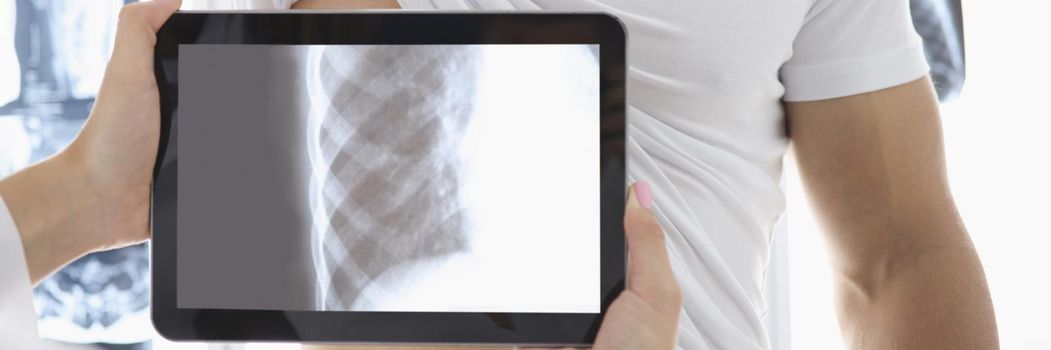 Medical worker put tablet device on patients body part and see ribs