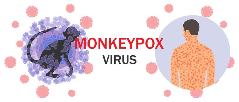 monkeypox virus, monkey, text,human body with rash