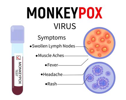 Test tube with blood for monkeypox virus test
