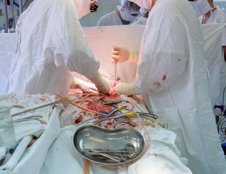 open heart surgery, surgeon, hands, instruments, blood.