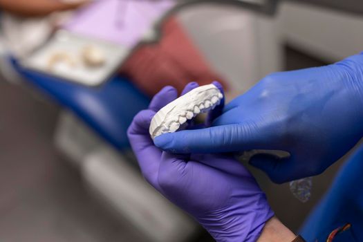 A dentist woman's hands holding a plaster denture at the dental clinic