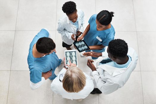 Merging their observations, expertise and decision-making responsibilities. High angle shot of a group of medical practitioners analysing brain scans on a digital tablet in a hospital.