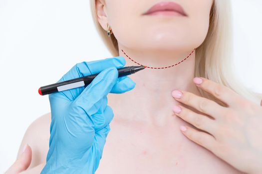 Plastic surgery doctor draw line on patient chin - cosmetic surgery concept.