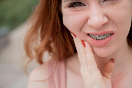 Young red-haired woman with braces suffering from pain.