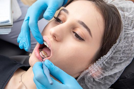 Dentist examining patient teeth with dental mirror. Dental check up concept