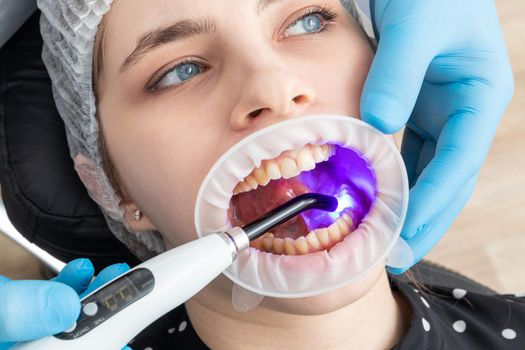 Closeup view of dentist using dental curing UV lamp on teeth of patient
