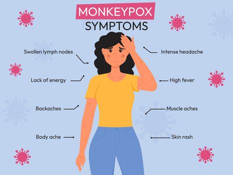 Monkeypox outbreak. Monkeypox virus symptoms infographic. Flat vector illustration for informing people about an infectious disease.