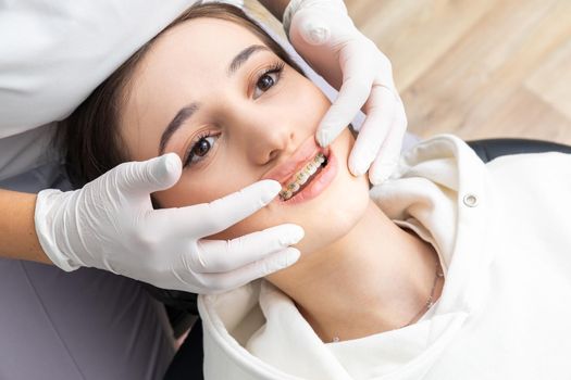 Orthodontist checking brackets on female teeth. Concept of stomatology, dentistry, orthodontic treatment