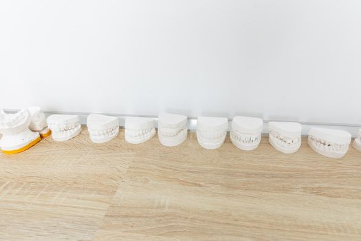 Row of Dental casting gypsum models plaster cast on a table