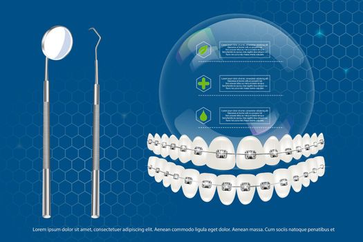 3d vector illustration, realistic teeth with upper and lower jaw braces on the background of infographics and tools. Alignment of the bite of teeth, dentition with braces, dental braces