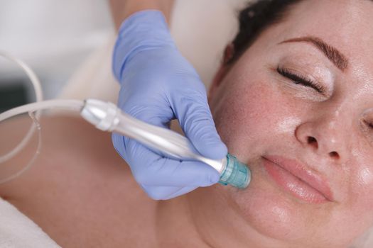 Woman getting facial hydra microdermabrasion at beauty salon