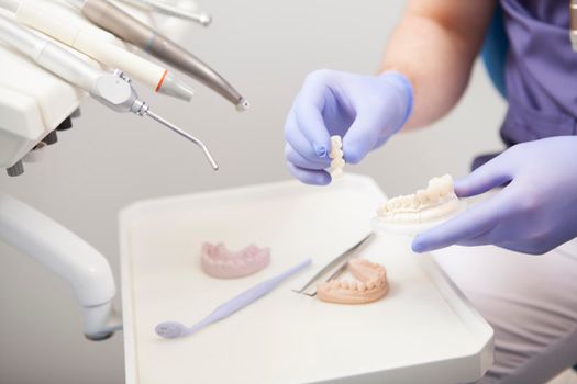Cropped shot of a dentist holding dental mold, dental tools on background