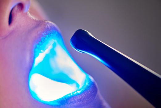 Getting a better view. a dentist examining a girls mouth with a ultraviolet light.
