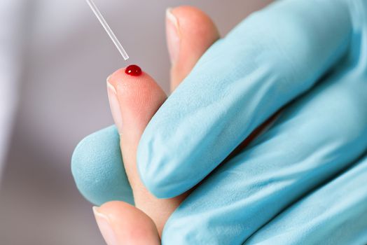 Doctor piercing patients finger with lancet in clinic closeup. Taking blood for close-up analysis, a clinical blood test