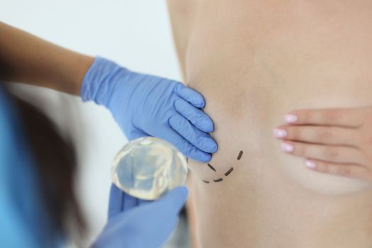 Surgeon holds silicone implant for breast augmentation