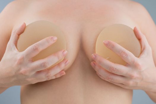 Caucasian naked woman trying on silicone breast implants. 