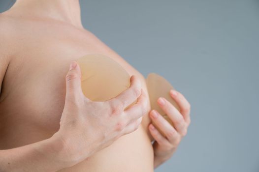 Caucasian naked woman trying on silicone breast implants on a white background.