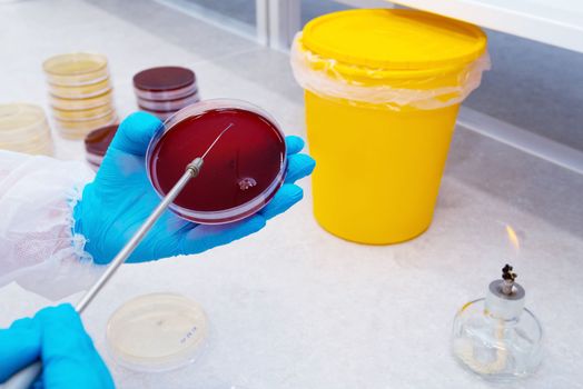 Hand Holds Petri Dish with Bacteria Culture
