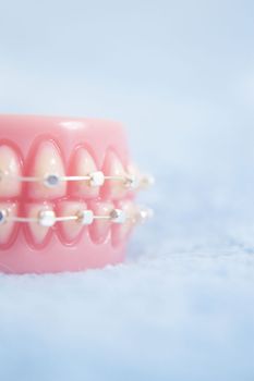 Metal orthodontic denture base