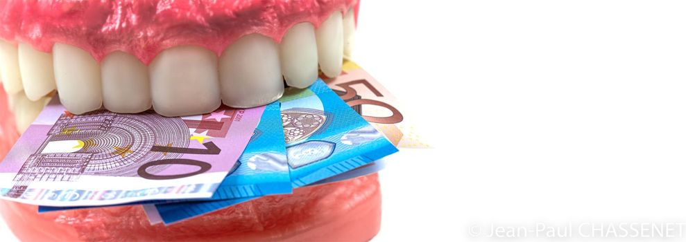 Expensive treatment- Educational dental typodon model and euro banknotes on white background.