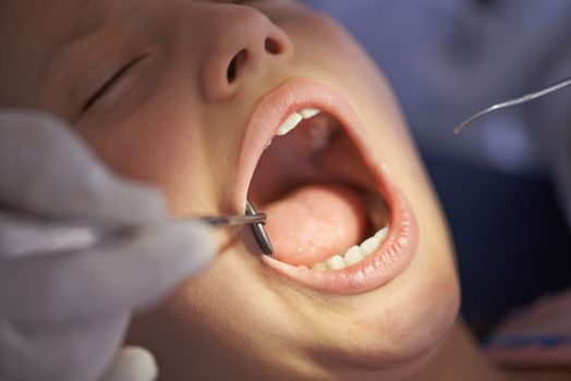 Just checking out your pearly whites. Closeup shot of a dentist performing a dental examination.
