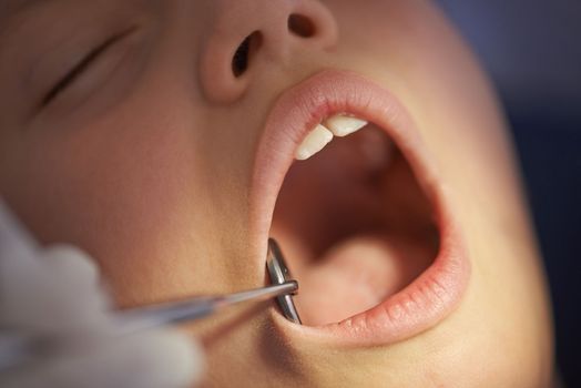 A growing girl needs a regular check up to see how her teeth are growing. Closeup shot of a dentist performing a dental examination