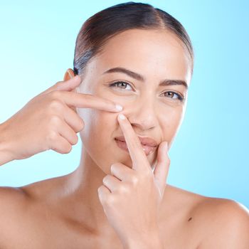 Skincare, portrait and woman squeeze a pimple in a studio for a natural facial treatment. Beauty, cosmetic and girl model from brazil with a face acne routine for health isolated by a blue background