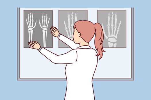 Woman surgeon applies X-ray of hand to luminous board to see sites of bone fracture. Vector image