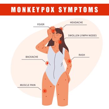 Monkeypox virus symptoms infographics. Woman with symptoms of Monkeypox. Fever, headache, rash. Information poster with symptoms of monkeypox virus. Woman suffering from the monkeypox virus