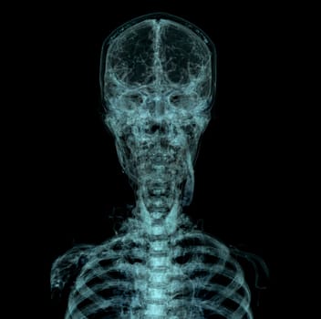 Human Skull, Brain by CT Scan. X-ray Visualization Inside Of Skull. 3D Illustration Render