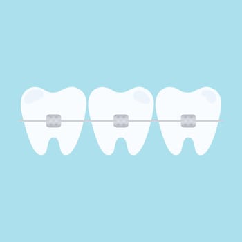 Teeth with braces. Dental braces. Orthodontic dentistry. Vector illustration
