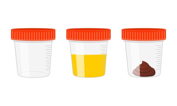 Urine and stool samples, empty and full plastic cups. Urinalysis, poo analysis set. Laboratory examination concept. Vector cartoon illustration